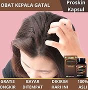 Obat Alami Kulit Kepala Gatal Rambut Rontok